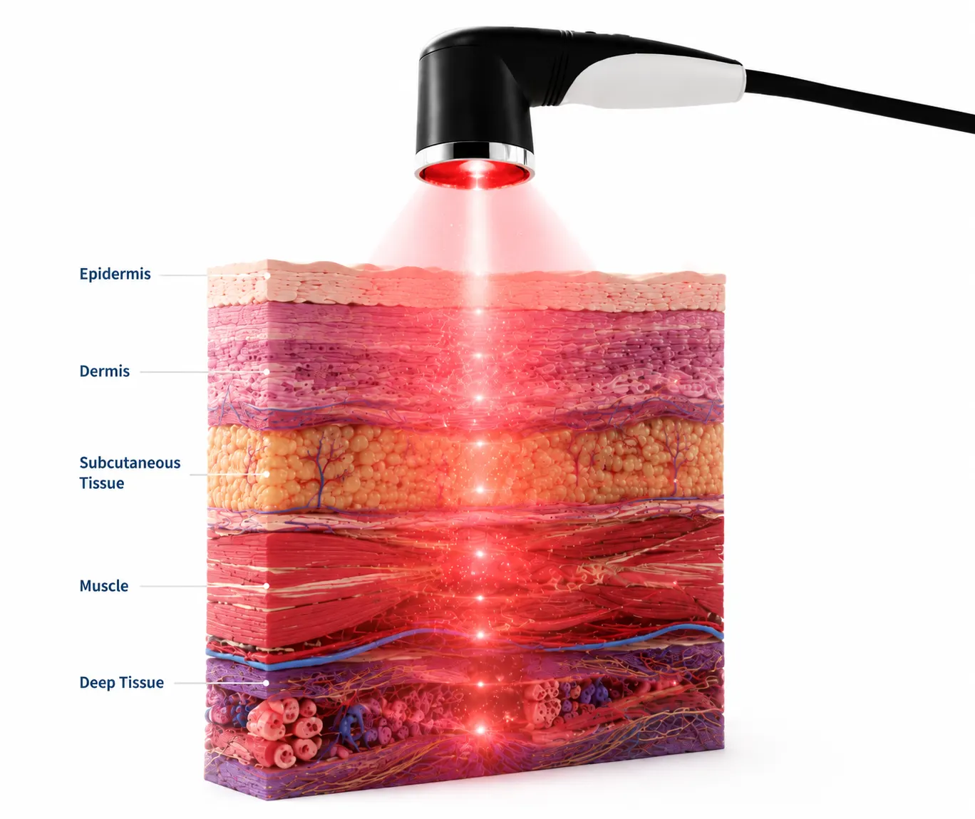 How Class IV Laser Therapy Works?