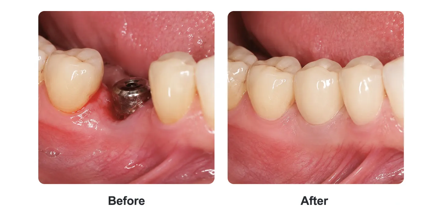 Implantology clinical examples