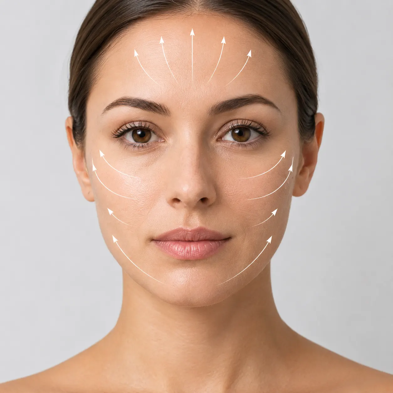 Facial laser lifting area