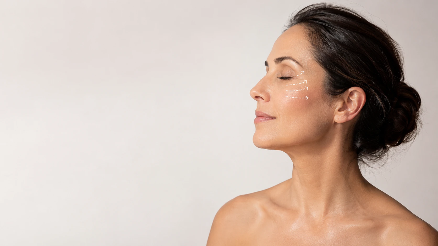 LYRA 1470nm laser system beside a laser facelift treatment profile