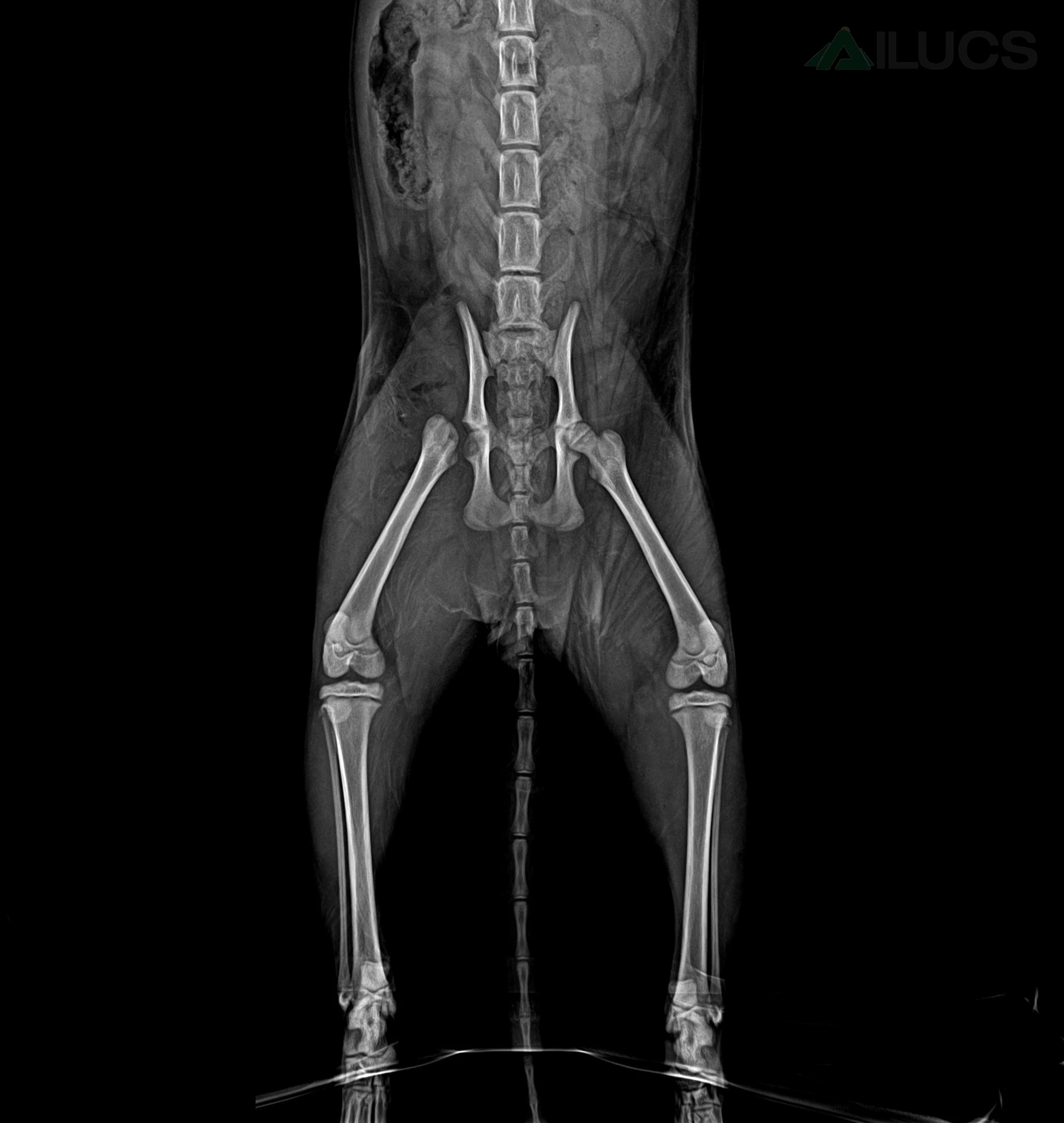 paipai-right-femoral-head-fracture-preoperative-xray.webp paipai-right-femoral-head-fracture-preoperative-xray.webp